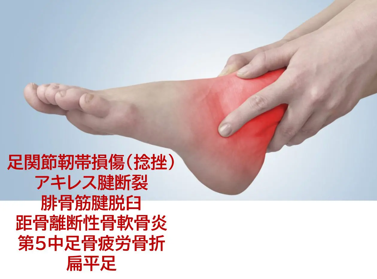 足部・足関節の評価と治療 足関節捻挫を中心とした足部疾患の改善に